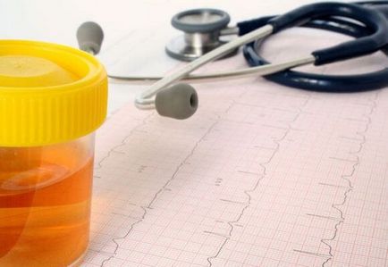 Vizelet kezelésére visszértágulat az alsó végtagok (vizelet) Vizelet kezelésére visszértágulat az alsó végtagok