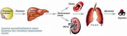 Mirosul acetonului din gura unui adult (motive)