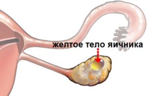 Жовте тіло в лівому яєчнику, що це таке