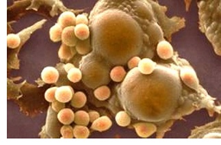 Celulele grase cum sunt aranjate și dacă este posibil să le distrugă