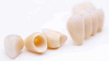 Implantul implantului cât de mult este implantarea dinților