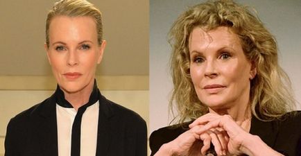 Kim Basinger de 63 de ani a speriat fanii cu fața ei nenaturală