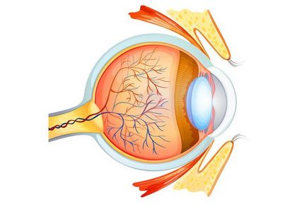 Ateroscleroza cauzată de vasele retinei, tratamentul simptomelor