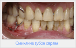 Biomecanica șei finale