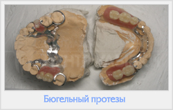 Biomecanica șei finale