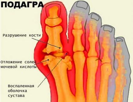 Хвороби суглобів в тибетській медицині