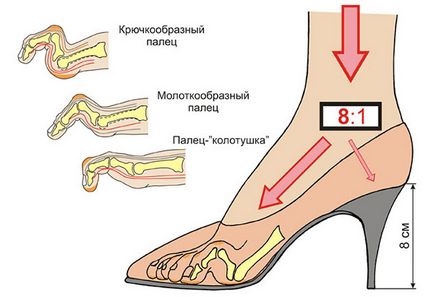 Întreruperea din mijloc provoacă din interiorul cauzei, diagnosticul, modul de tratare, prevenirea