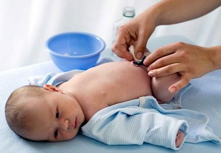 Cum și cum să procesăm ombilicul unui nou-născut cu un clothespin și fără