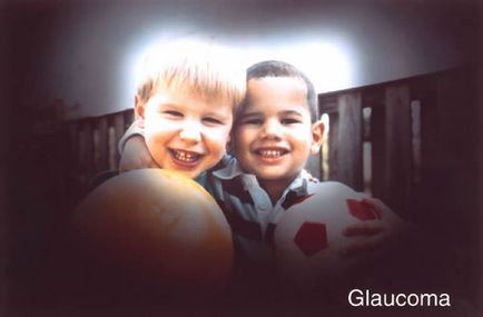 Ce trebuie să faceți dacă aveți un atac acut de glaucom