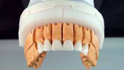 A cirkónium korona elülső fogak bizonyos berendezésben, jelzések, árak