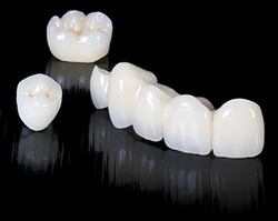 Цирконієві зубні коронки за доступними цінами
