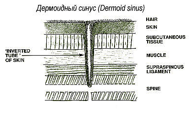 Dermaid sinus