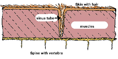 Dermaid sinus