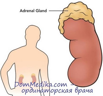 Diagnosticul aldosteronismului primar