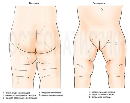 Displazie, osteopatie