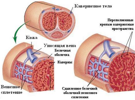 Доплерографія судин статевого члена як проводиться і що показує