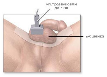 Dopplerografia vaselor penisului efectuată și ce arată