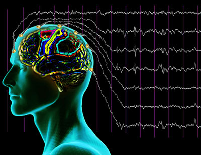 EEG cu privare de somn - minunat despre frumosul mod de viață