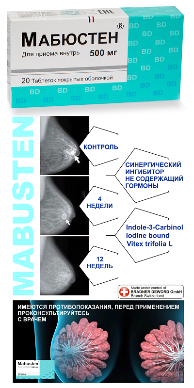 Tratamentul eficient al adenozelor glandelor mamare