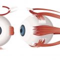 A genetikai hajlam a myopia, körülbelül szembetegség (hajlam) A genetikai hajlam myopia, körülbelül szembetegség