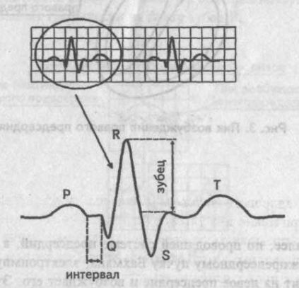 A Genesis a fő fogak, hornyok és EKG szegmensek - kardiológus - helyén a szív és az erek betegségek