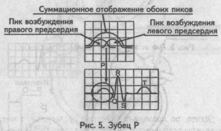 A Genesis a fő fogak, hornyok és EKG szegmensek - kardiológus - helyén a szív és az erek betegségek