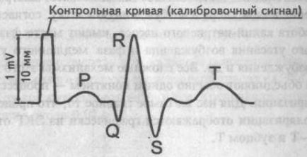 Generarea dinților de bază, intervale și segmente ecg - cardiolog - site despre bolile inimii și vaselor de sânge