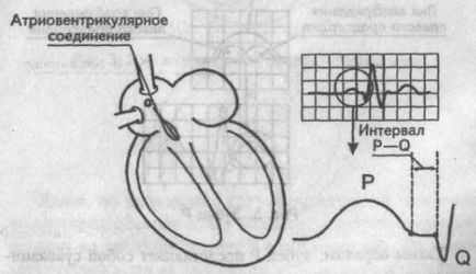 A Genesis a fő fogak, hornyok és EKG szegmensek - kardiológus - helyén a szív és az erek betegségek