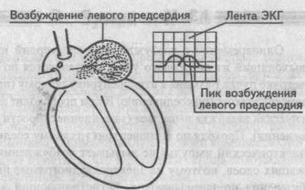 Generarea dinților de bază, intervale și segmente ecg - cardiolog - site despre bolile inimii și vaselor de sânge