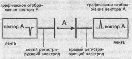 A Genesis a fő fogak, hornyok és EKG szegmensek - kardiológus - helyén a szív és az erek betegségek