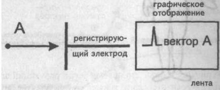 A Genesis a fő fogak, hornyok és EKG szegmensek - kardiológus - helyén a szív és az erek betegségek