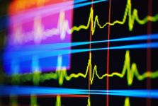 Generarea dinților de bază, intervale și segmente ecg - cardiolog - site despre bolile inimii și vaselor de sânge