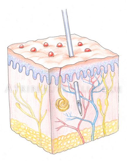 Acidul hialuronic, centrul de cosmetologie