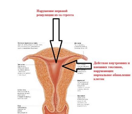 endometriális hiperplázia