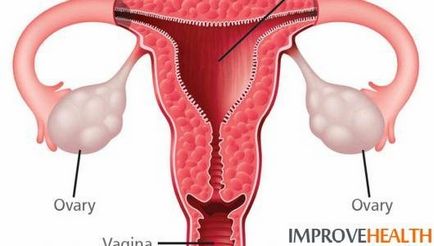 Care ar putea fi consecințele după îndepărtarea trompelor uterine de viața mea