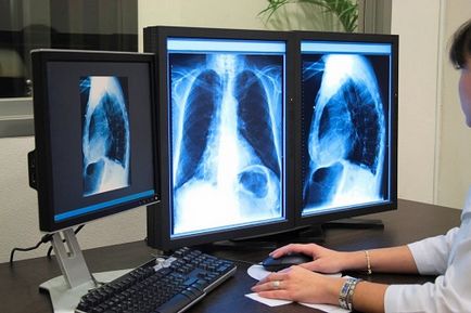 Ce fel de tulburări poate arăta o tomografie computerizată a plămânilor?
