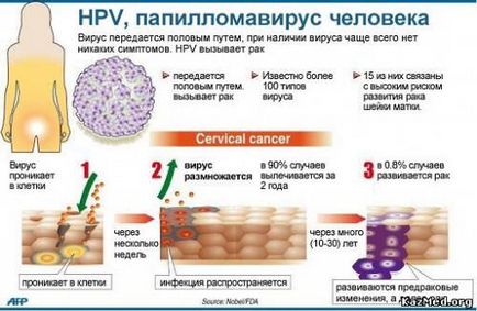 Hogyan lehet megszabadulni a papilloma vírus fertőzés a nyak