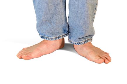 Як лікувати натоптиші на підошві ніг в домашніх умовах народні способи