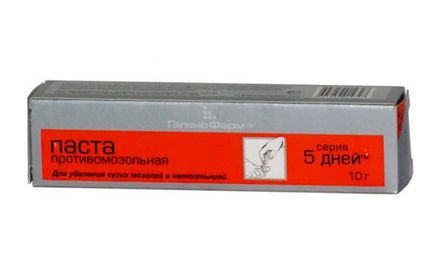 Як лікувати натоптиші на підошві ніг в домашніх умовах народні способи