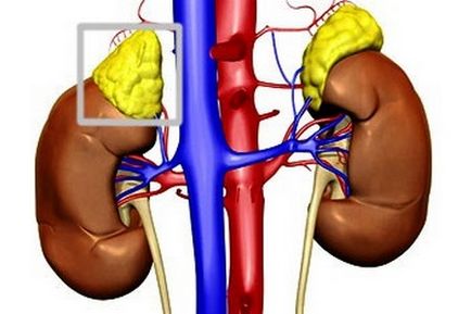 Chisturile suprarenale cauzeaza, simptomele si tratamentul