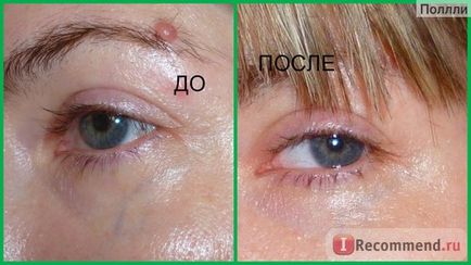 Крем для шкіри навколо очей shiseido bio-performance super corrective eye cream - «крем від зморшок,