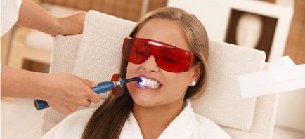 Laser de dinți cu laser albire zâmbet fermecător - stomatologie pe taganke