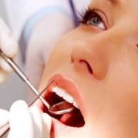 Tratamentul parodontozei cu metode populare - bisturiu - informație medicală-educativă