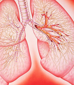 Pulmonar hemoragie primul ajutor