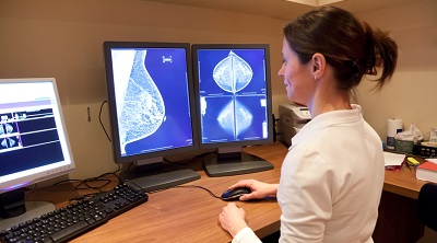 Мамографія або узі молочних залоз