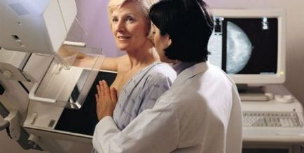 Mamografie sau ultrasunete mamar