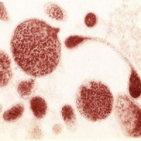 Mycoplasma și ureaplasma simptome speciale, medicamente pentru tratament - site-ul medical - semafoare