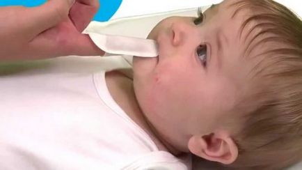 A szájpenész a nyelv csecsemők, kezelése candidiasis csecsemők okai