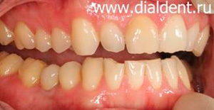 Pot introduce o nouă căutare a dinților pentru opțiunile de tratament și rezolva problema