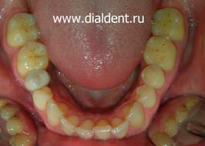 Pot introduce o nouă căutare a dinților pentru opțiunile de tratament și rezolva problema